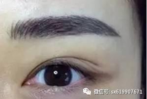 绿蜜瓜黑眉毛可以吃吗图片,揭秘能否安全食用的真相
