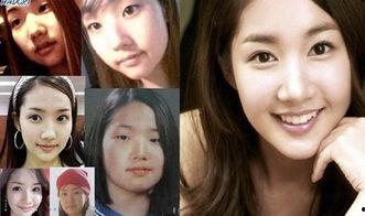 整容女明星网红有哪些,美丽背后的秘密