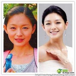 变性整容明星网红是谁,揭秘明星级变性整容明星的蜕变之路